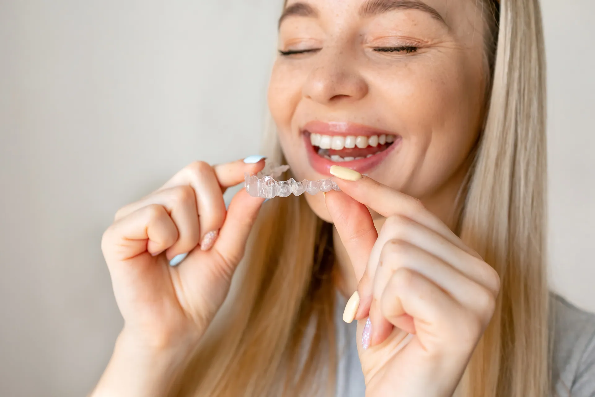 Clarity aligners technology showcase